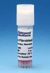 fibroblasts
