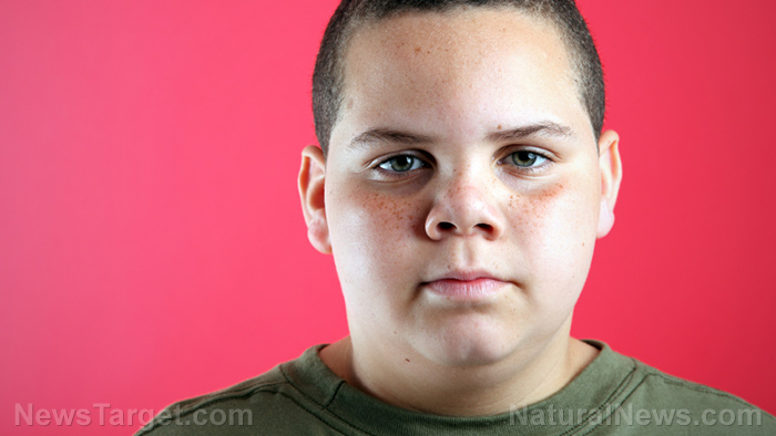 Overweight-Child-Boy-Teen-Angry