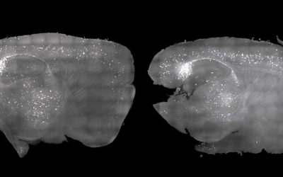 Scientists Cleared Alzheimer’s Plaque From Mice Using Nothing but Light and Sound