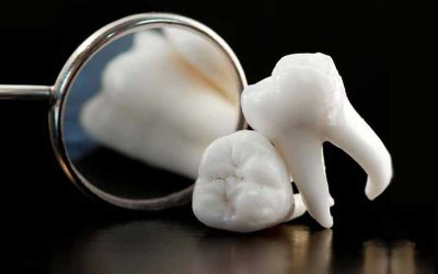 Human “micro-evolution” clear as more babies born without wisdom teeth and with extra artery