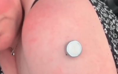 Why are Magnets Sticking to the COVID Vaxxed?