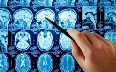 Study Concludes Mercury Can Now Be Listed “As A Cause of Autism”
