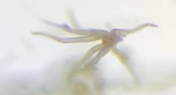 COVID Vax Creatures: Live, Self-Aware Critters Found Under Microscope